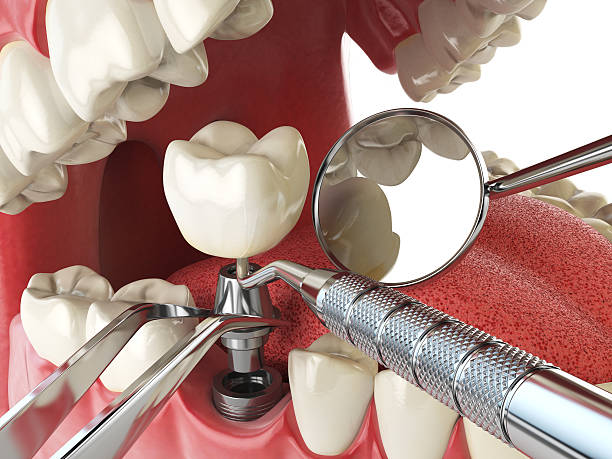 Best Emergency Treatment for Jaw Pain or Injury in , KS