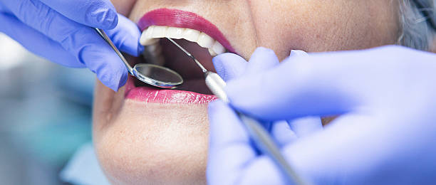 Best Broken or Chipped Tooth Repair in , KS